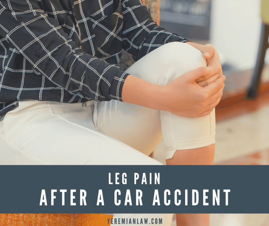 Leg Pain After a Car Accident - Glendale Personal Injury Lawyers