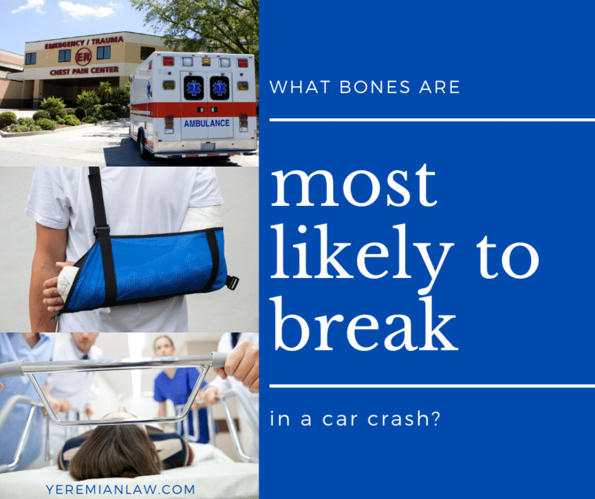 What Bones Are Most Likely to Be Broken in a Car Crash